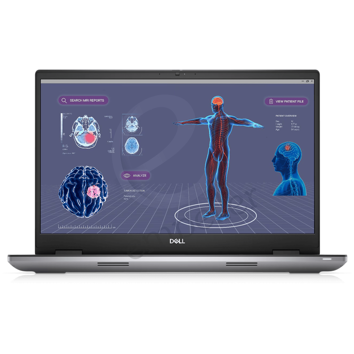 Dell Precision 7780 Mobile Workstation