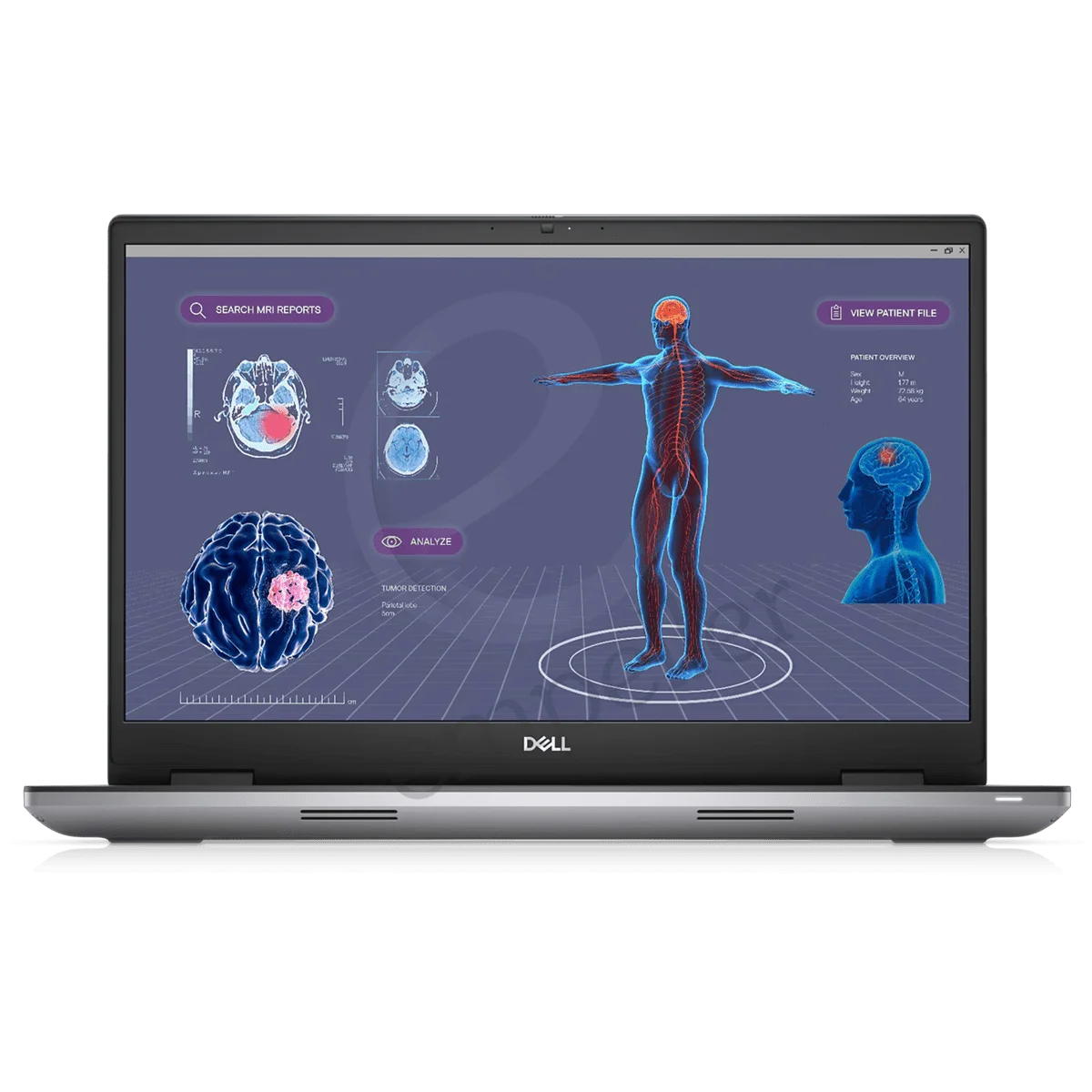 Dell Precision 7780 Mobile Workstation